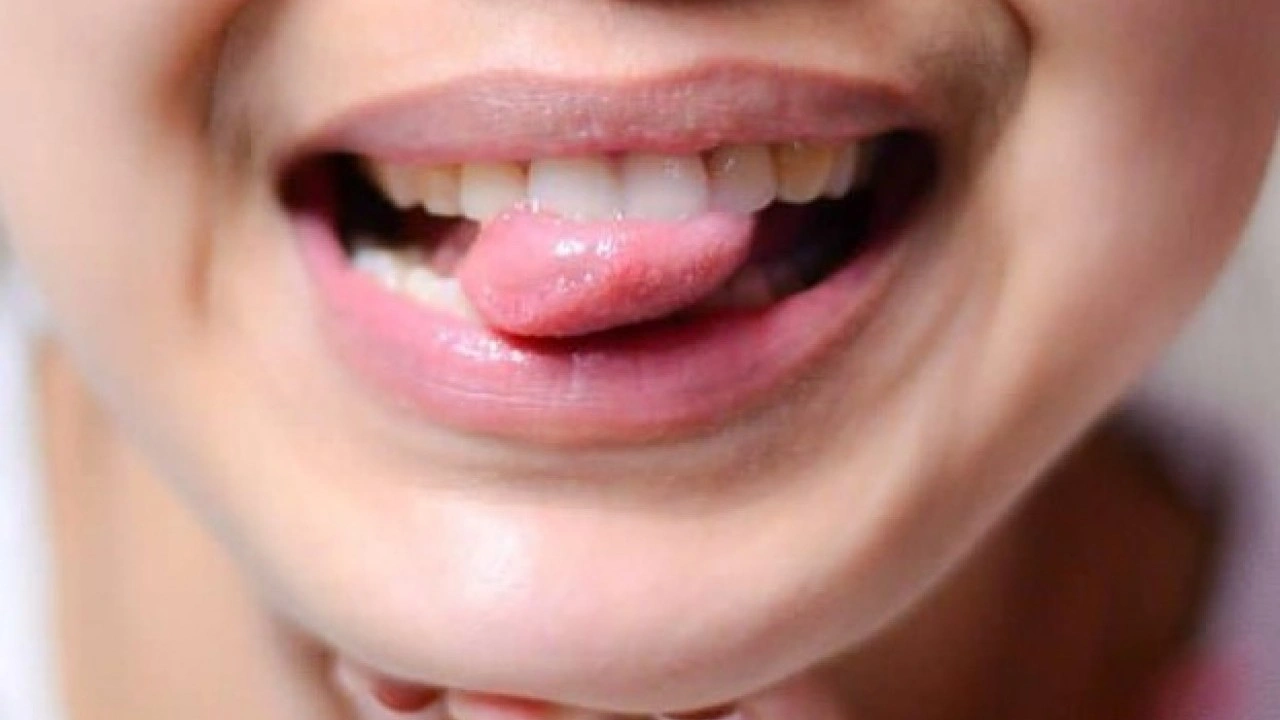 Hastalığın habercisi! Diliniz bu renkteyse dikkat