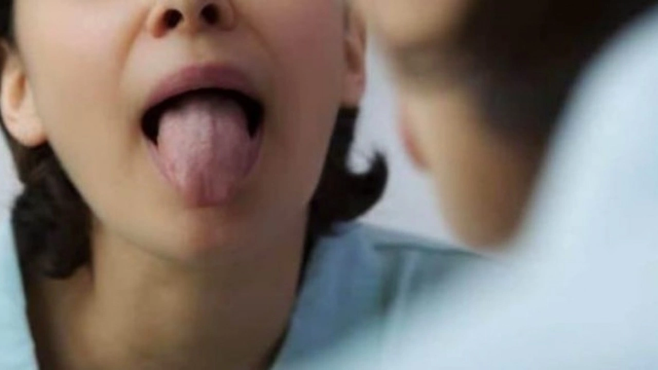 Foto - Hastalığın habercisi! Diliniz bu renkteyse dikkat