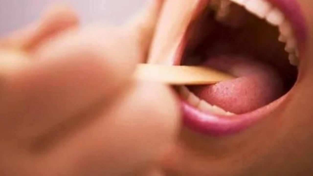 Foto - Hastalığın habercisi! Diliniz bu renkteyse dikkat