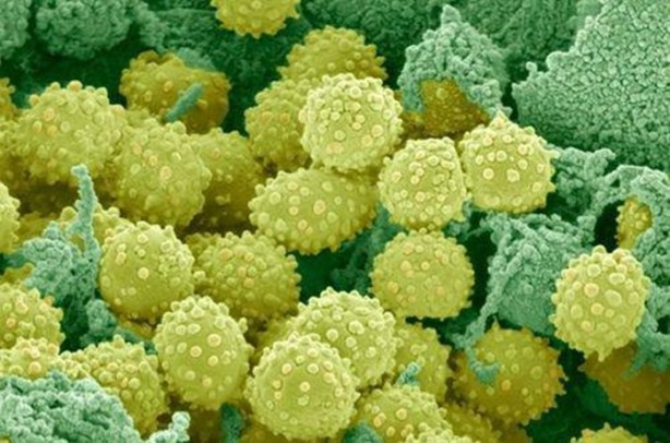 Foto - Hastalıklardan korunmanın 16 yolu