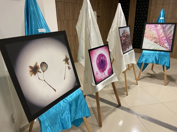 Foto - Hastalıklı dokular sanat eserine dönüştü