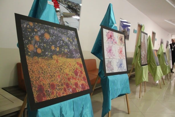 Foto - Hastalıklı dokular sanat eserine dönüştü