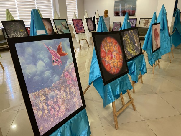 Foto - Hastalıklı dokular sanat eserine dönüştü