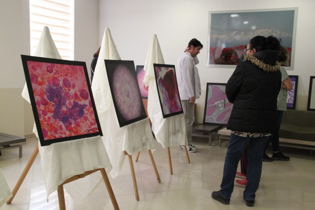 Foto - Hastalıklı dokular sanat eserine dönüştü