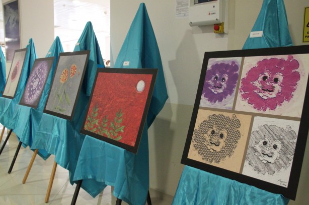 Foto - Hastalıklı dokular sanat eserine dönüştü