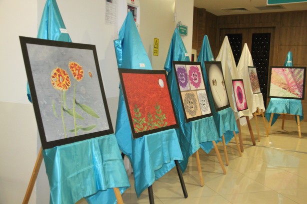 Foto - Hastalıklı dokular sanat eserine dönüştü