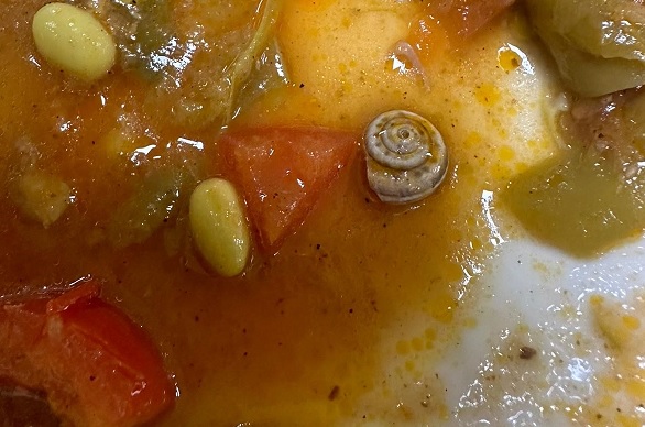 Hastane yemeğinden salyangoz çıktı!