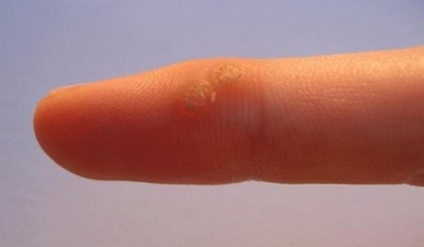 Foto - Hayat kolaylaştıran pratik bilgiler