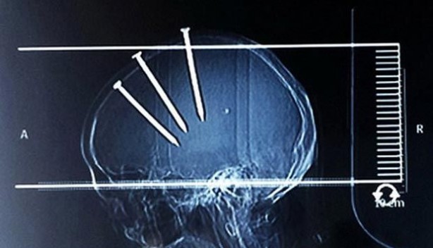 Hayrete düşeceksiniz!