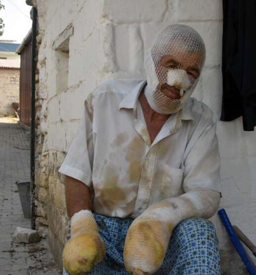 Foto - Hayvan sevgisi bu hale getirdi