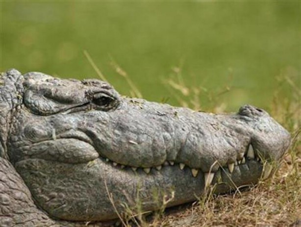 Foto - Hayvandan insana geçiyor! Beyni istila edip öldürüyor