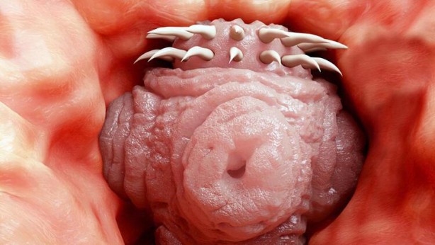 Foto - Hayvandan insana geçiyor! Beyni istila edip öldürüyor