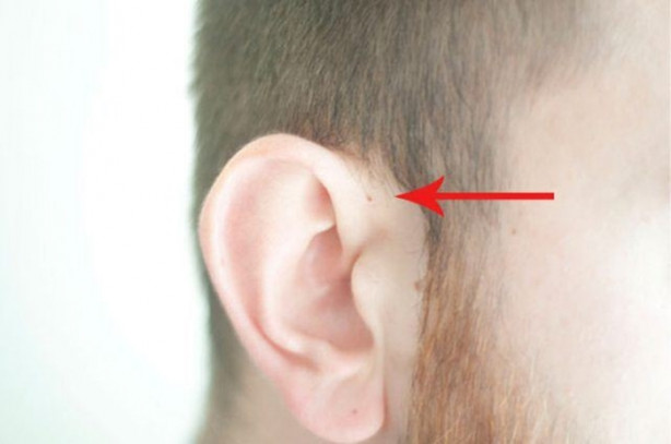 Foto - Hemen kontrol edin, sizde de bu küçük delikten olabilir!