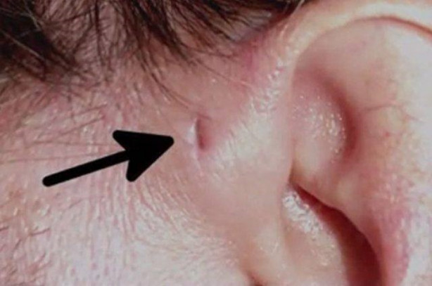 Foto - Hemen kontrol edin, sizde de bu küçük delikten olabilir!