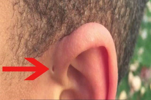 Hemen kontrol edin, sizde de bu küçük delikten olabilir!