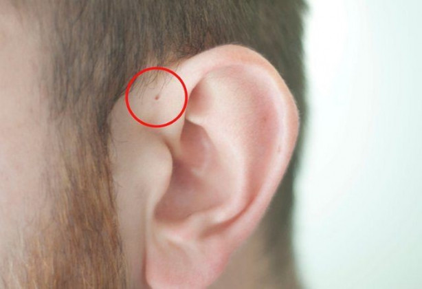 Foto - Hemen kontrol edin, sizde de bu küçük delikten olabilir!