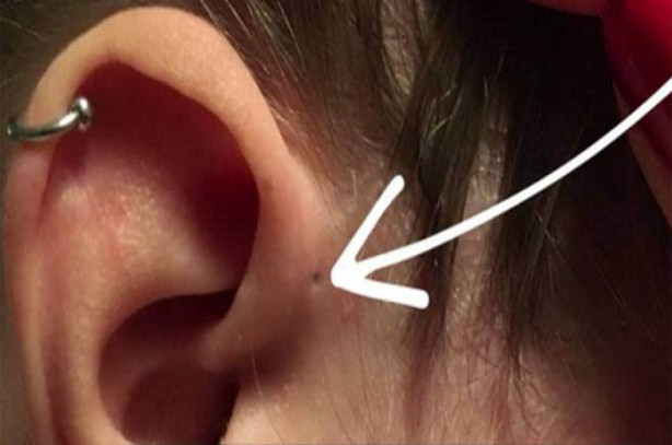 Foto - Hemen kontrol edin, sizde de bu küçük delikten olabilir!