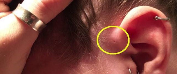 Foto - Hemen kontrol edin, sizde de bu küçük delikten olabilir!