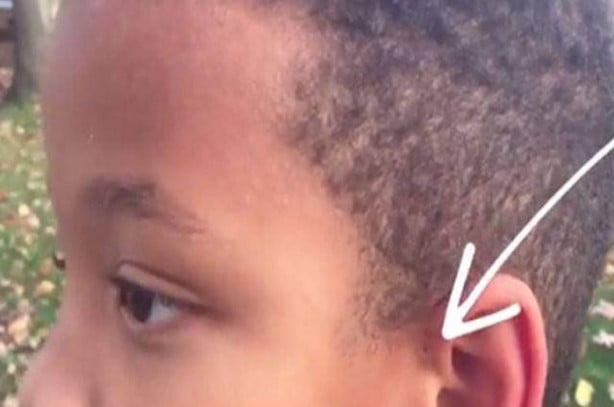 Foto - Hemen kontrol edin, sizde de bu küçük delikten olabilir!