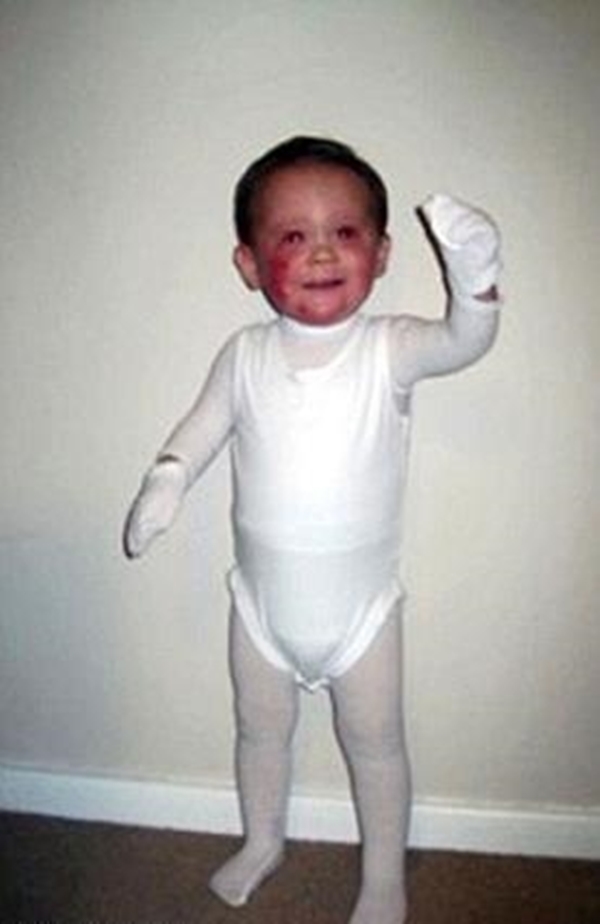 Foto - Henüz 5 yaşında ama ölmek istiyor