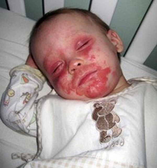 Foto - Henüz 5 yaşında ama ölmek istiyor