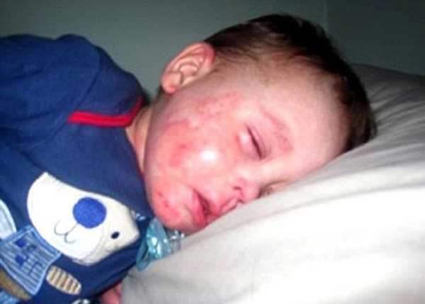 Foto - Henüz 5 yaşında ama ölmek istiyor