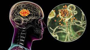 Foto - Hepimiz bilmeden her gün tüketiyoruz ancak beyni küçültüyor! Zarar verdiği ortaya çıktı