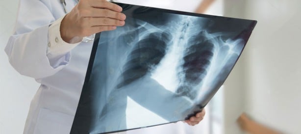 Hepsi birbirinden korkunç! Doktorları bile şaşkına çeviren görüntüler