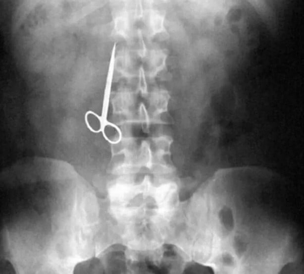 Foto - Hepsi birbirinden korkunç! Doktorları bile şaşkına çeviren görüntüler