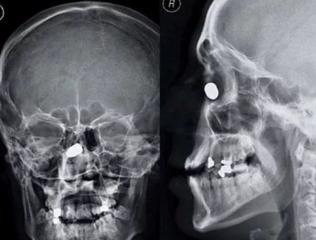 Foto - Hepsi birbirinden korkunç! Doktorları bile şaşkına çeviren görüntüler