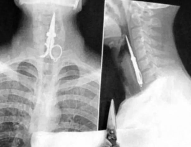 Foto - Hepsi birbirinden korkunç! Doktorları bile şaşkına çeviren görüntüler