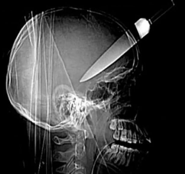 Foto - Hepsi birbirinden korkunç! Doktorları bile şaşkına çeviren görüntüler