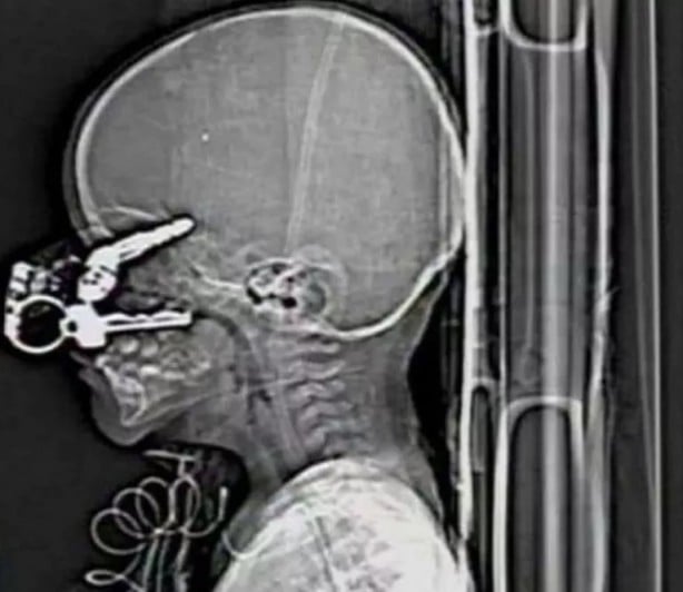 Foto - Hepsi birbirinden korkunç! Doktorları bile şaşkına çeviren görüntüler