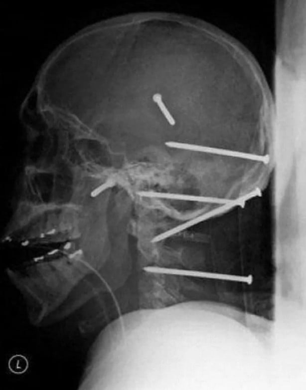 Foto - Hepsi birbirinden korkunç! Doktorları bile şaşkına çeviren görüntüler