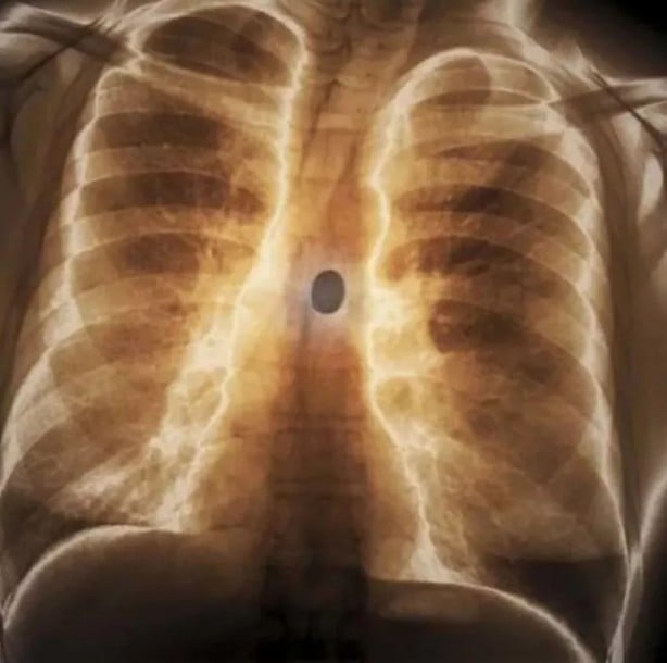 Foto - Hepsi birbirinden korkunç! Doktorları bile şaşkına çeviren görüntüler