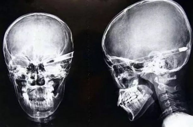 Foto - Hepsi birbirinden korkunç! Doktorları bile şaşkına çeviren görüntüler