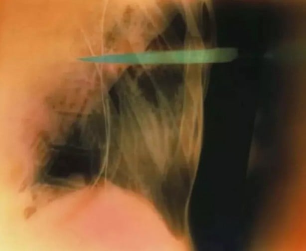 Foto - Hepsi birbirinden korkunç! Doktorları bile şaşkına çeviren görüntüler