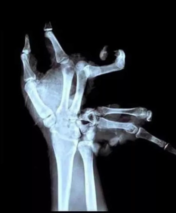 Foto - Hepsi birbirinden korkunç! Doktorları bile şaşkına çeviren görüntüler