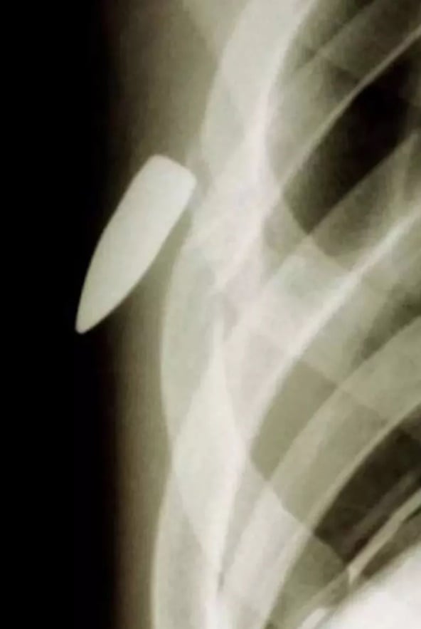 Foto - Hepsi birbirinden korkunç! Doktorları bile şaşkına çeviren görüntüler