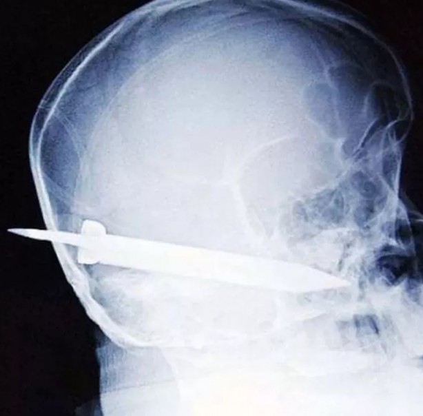 Foto - Hepsi birbirinden korkunç! Doktorları bile şaşkına çeviren görüntüler