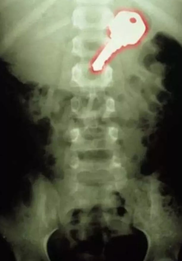 Foto - Hepsi birbirinden korkunç! Doktorları bile şaşkına çeviren görüntüler