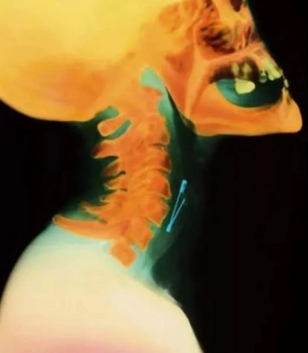 Foto - Hepsi birbirinden korkunç! Doktorları bile şaşkına çeviren görüntüler