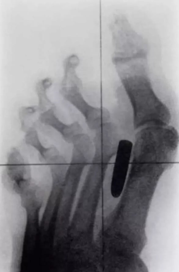 Foto - Hepsi birbirinden korkunç! Doktorları bile şaşkına çeviren görüntüler