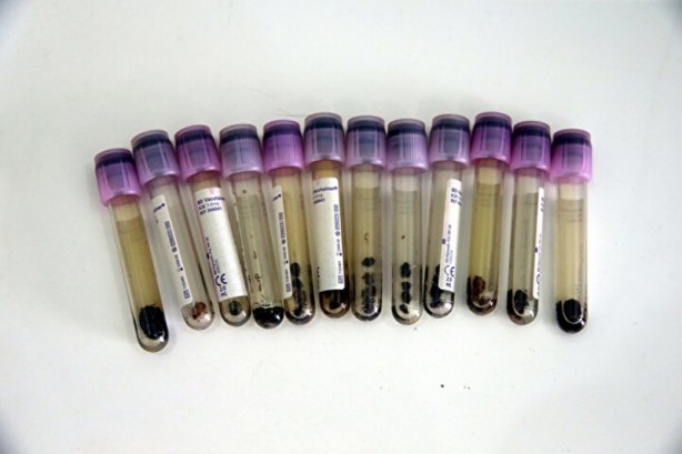 Foto - Hepsi Türkiye'de ortaya çıktı! İnsanlara ve hayvanlara hastalık taşıyorlar