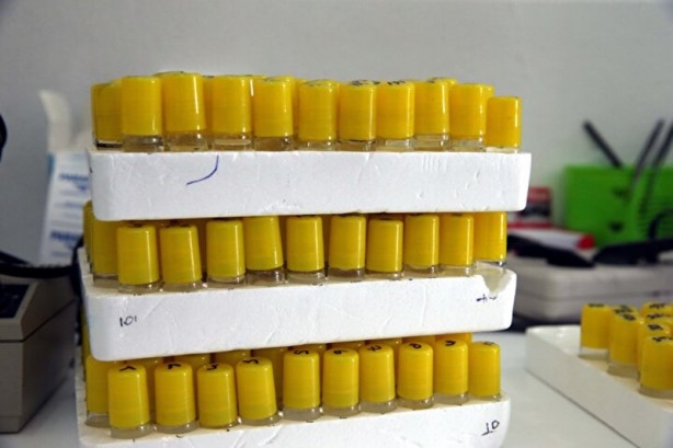 Foto - Hepsi Türkiye'de ortaya çıktı! İnsanlara ve hayvanlara hastalık taşıyorlar