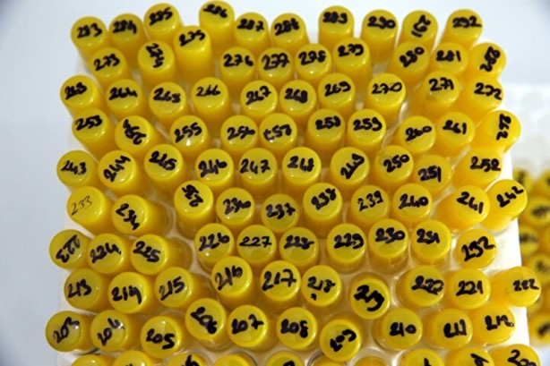 Foto - Hepsi Türkiye'de ortaya çıktı! İnsanlara ve hayvanlara hastalık taşıyorlar