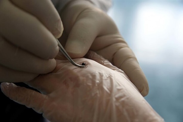 Foto - Hepsi Türkiye'de ortaya çıktı! İnsanlara ve hayvanlara hastalık taşıyorlar