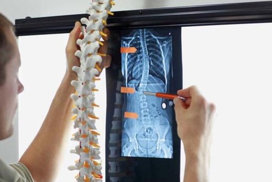 Hepsi vitamin deposu! İşte kemikleri güçlendiren besinler