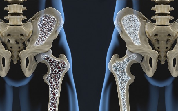 Foto - Her 3 kadının ve her 5 erkeğin 1’in görülüyor Günde sadece yarım saat ile kurtulabilirsiniz