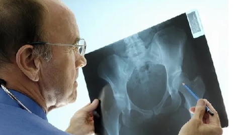 Foto - Her bir kemiği çeliğe dönüştürecek formül! Romatolog önerdi: Kemik erimesini bitiriyor! Duyan hemen almaya başladı